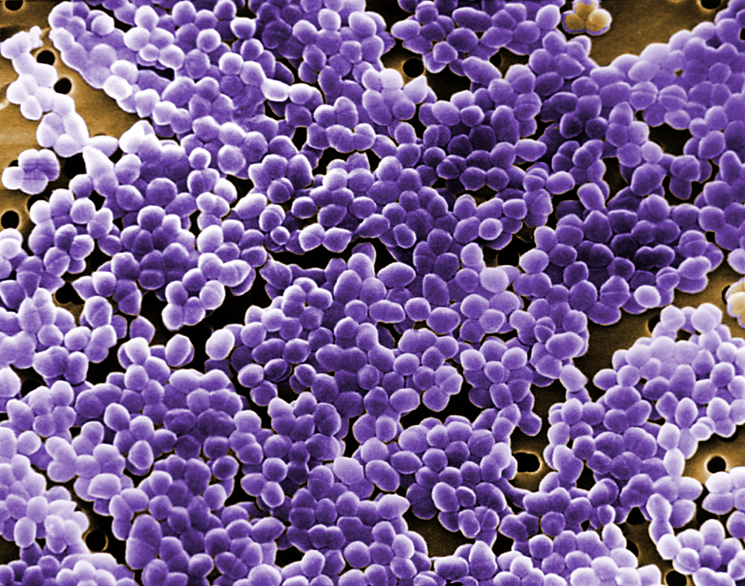 Digitally colorized scanning electron microscopic (SEM) of Enterococcus faecium bacteria. Copyright holder: Janice Haney Carr. Link: https://phil.cdc.gov/Details.aspx?pid=12802.
