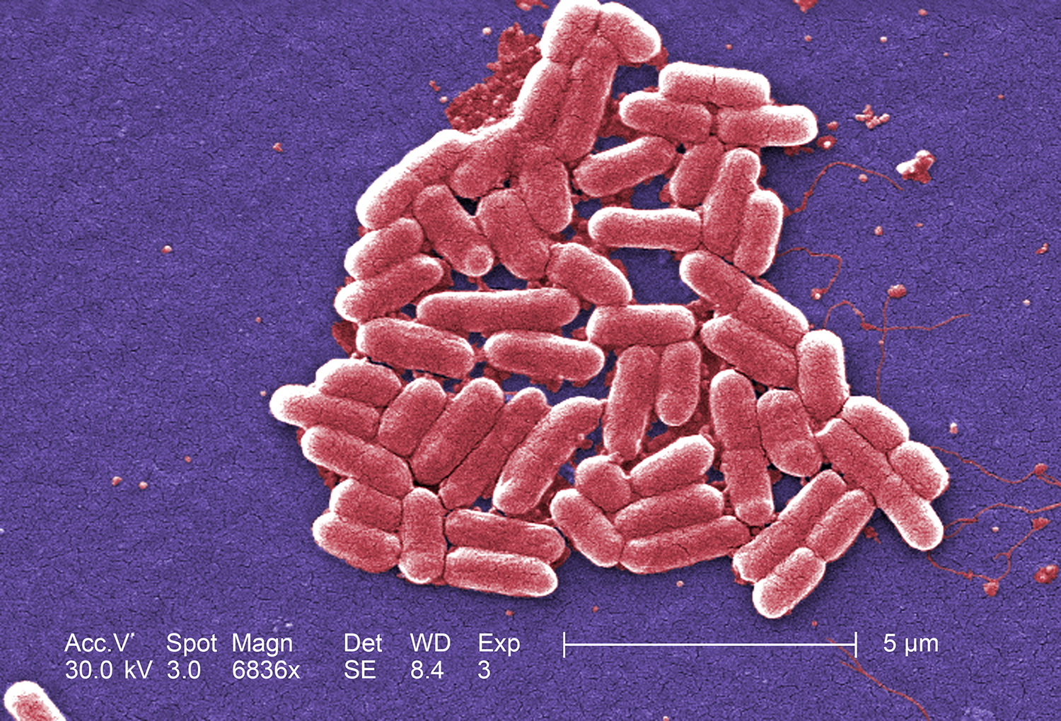 Digitally colorized scanning electron microscopic (SEM) of Escherichia coli bacteria. Copyright holder: Janice Haney Carr. Link: https://phil.cdc.gov/Details.aspx?pid=10068.