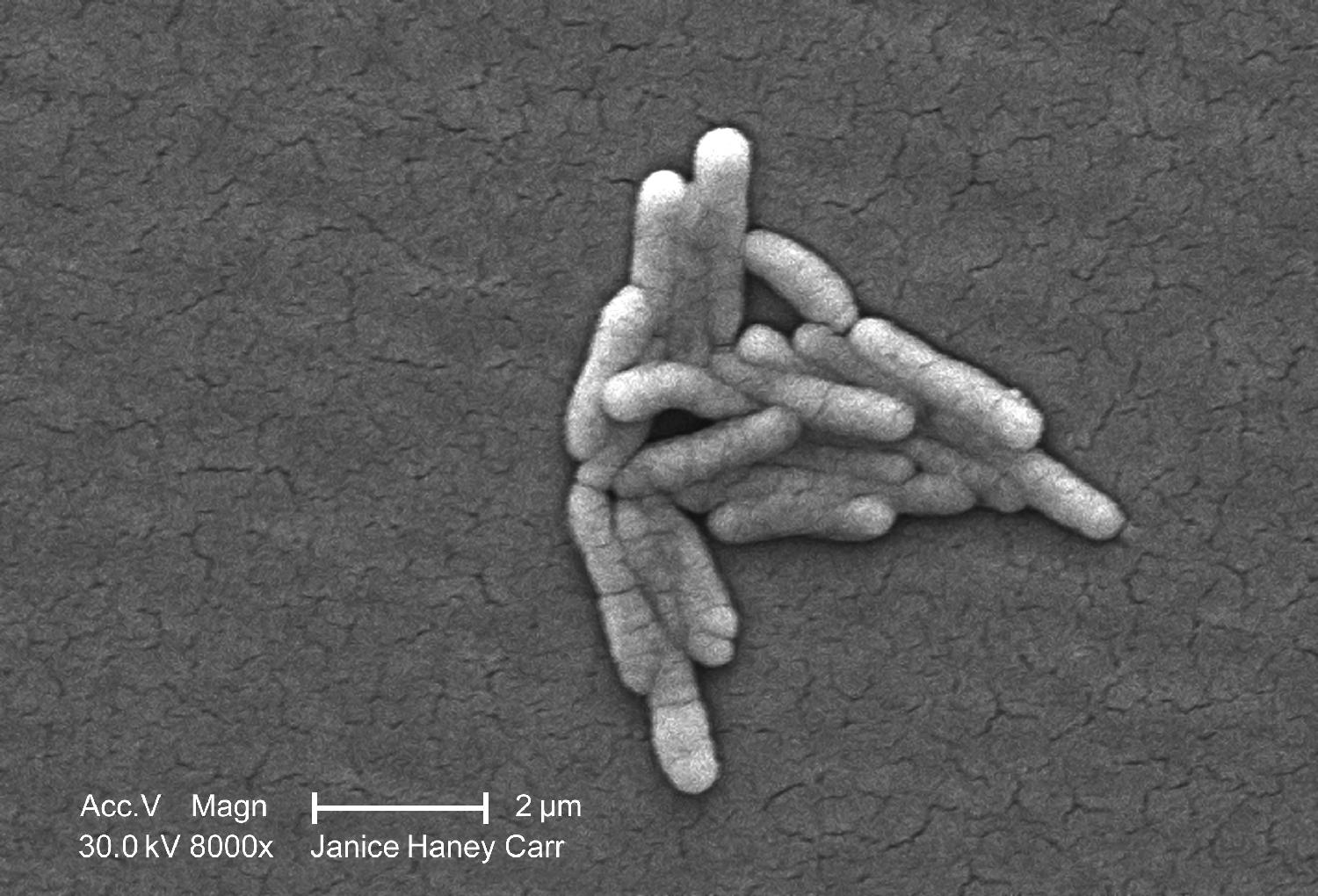 Scanning electron microscopic (SEM) of Salmonella enterica bacteria. Copyright holder: Janice Haney Carr. Link: https://phil.cdc.gov/Details.aspx?pid=10986.