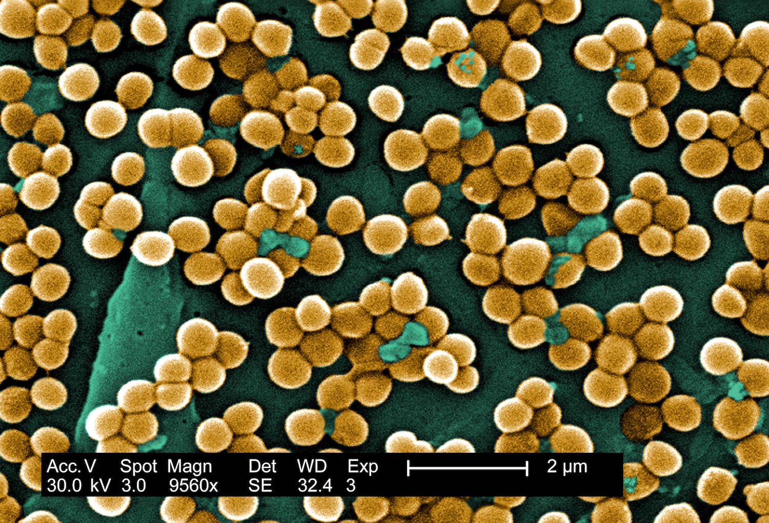 Digitally colorized scanning electron microscopic (SEM) of Staphylococcus aureus bacteria. Copyright holder: Janice Haney Carr. Link: https://phil.cdc.gov/Details.aspx?pid=10046.